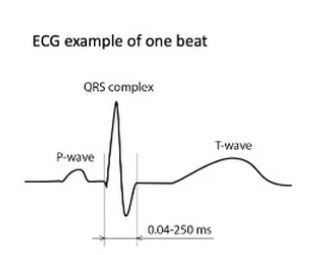 ECG - ai cardiology