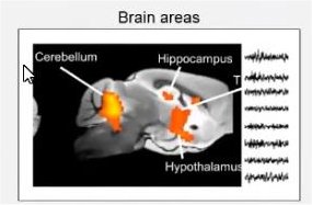 Brain areas