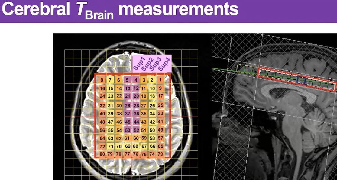 Bain temperatures. The Brain Conference - UK